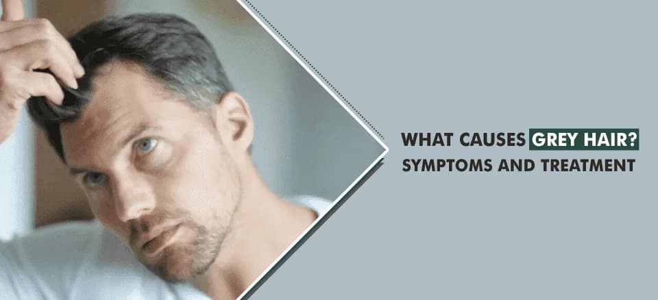 What Causes Grey Hair-Symptoms and Treatment