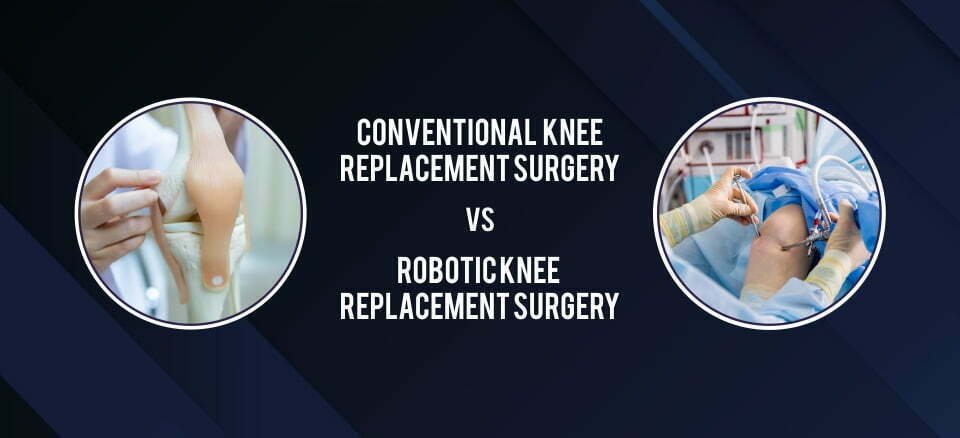 Conventional Knee Replacement Surgery VS Robotic Knee Replacement Surgery