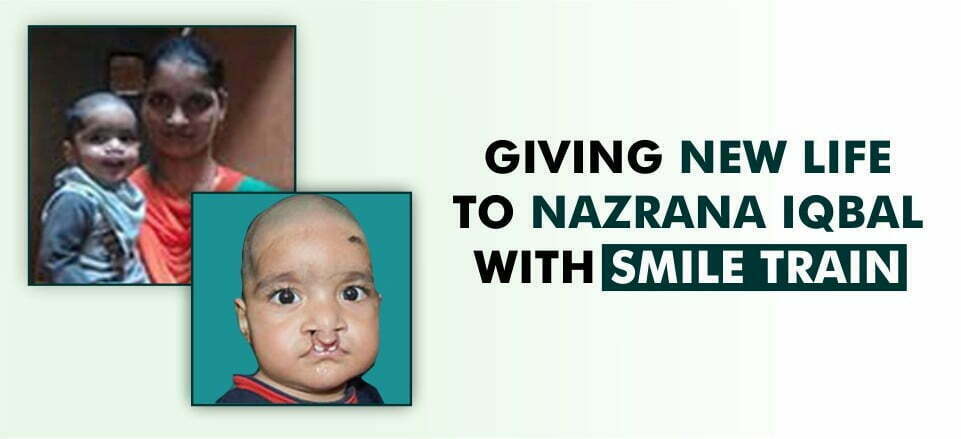 Giving New Life To Nazrana Iqbal with Smile Train