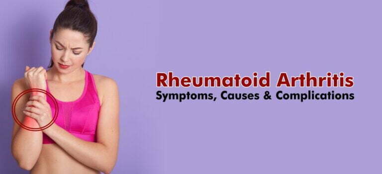 Rheumatoid Arthritis – Symptoms, Causes and Complications