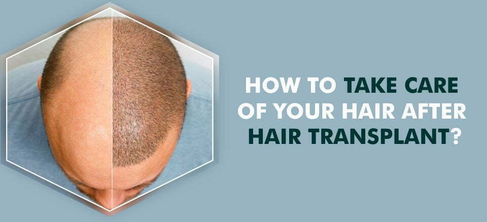 How to take care of your hair after a hair transplant?