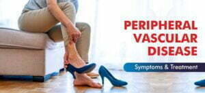 Peripheral Vascular Disease (PVD)- Amandeep Hospital