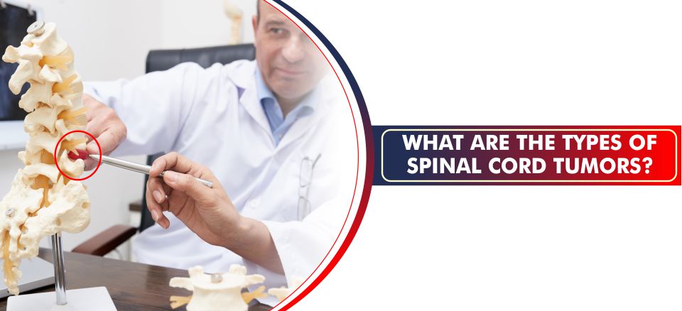What are the types of spinal cord tumors
