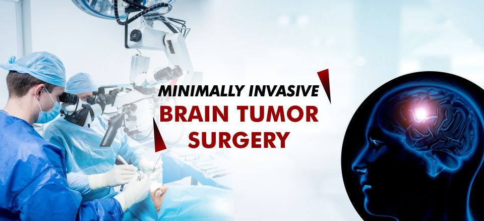 Minimally Invasive Brain Tumor Surgery