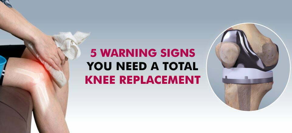 5 Warning signs you need a total knee replacement