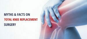 Total Knee Replacement Surgery - Myths and Facts | Amandeep Hospital