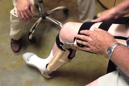 prosthetics-and-orthotics