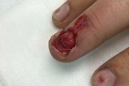 skin-and-nail-care