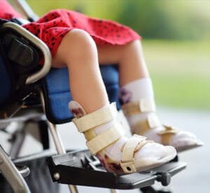 Pediatric Orthopedic Surgeon India | Amandeep Hospital