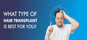 Types Of Hair Transplant That Best Fits You | Amandeep Hospital