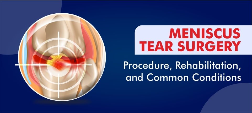 meniscus tear surgery-min