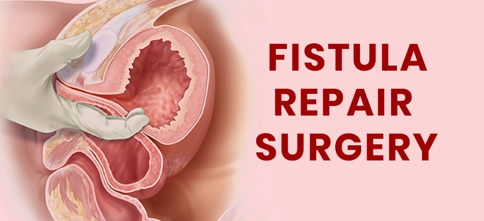 Fistula Repair Surgery
