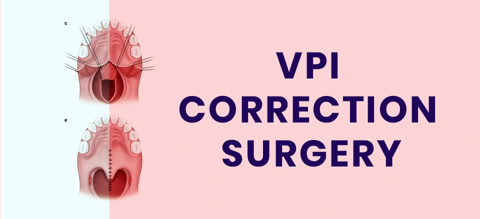 VPI Correction Surgery