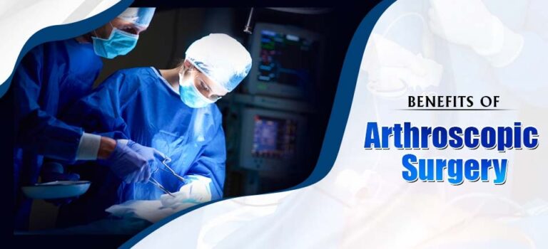 Benefits Of Arthroscopic Surgery Over Traditional Surgery 8591