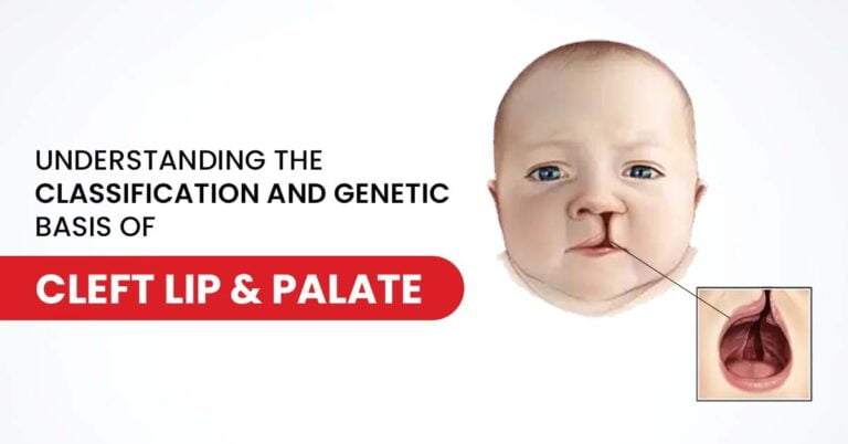 Understanding Genetic Basis Of Cleft Lip And Palate