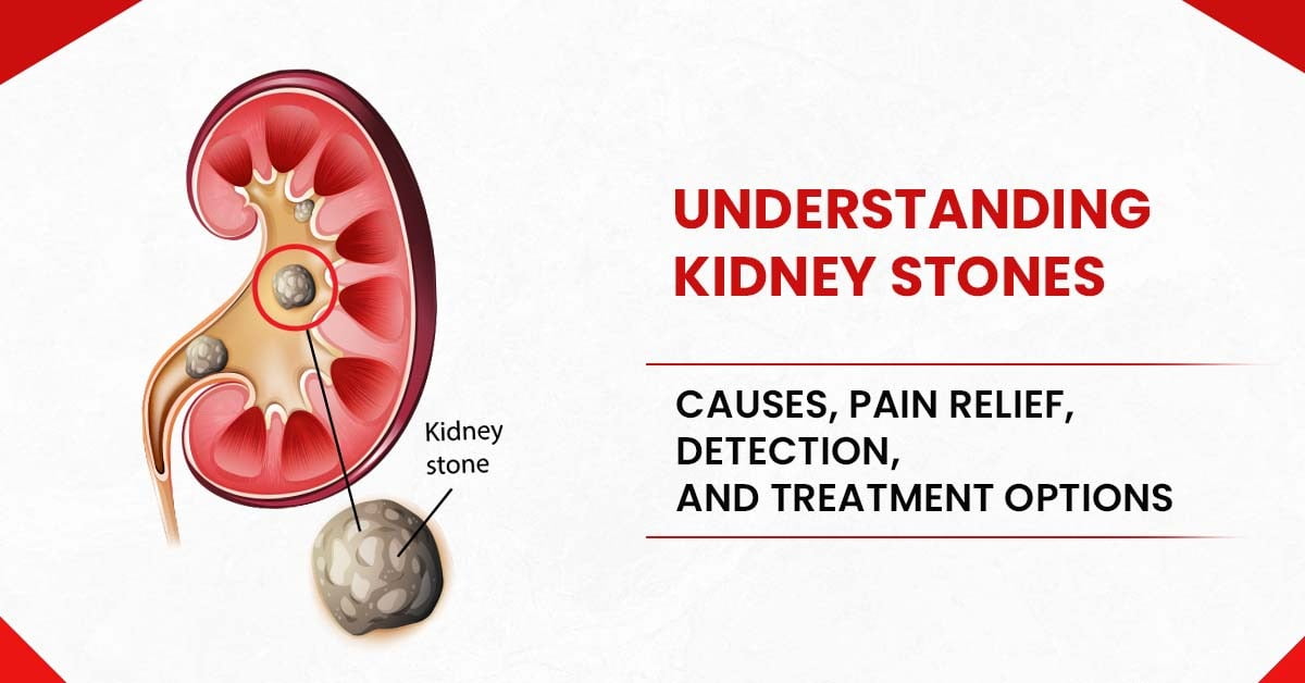 Understanding Kidney stones