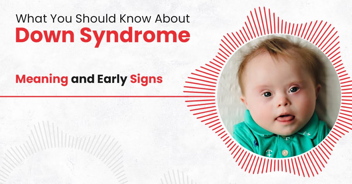 Down Syndrome Meaning and Early Signs