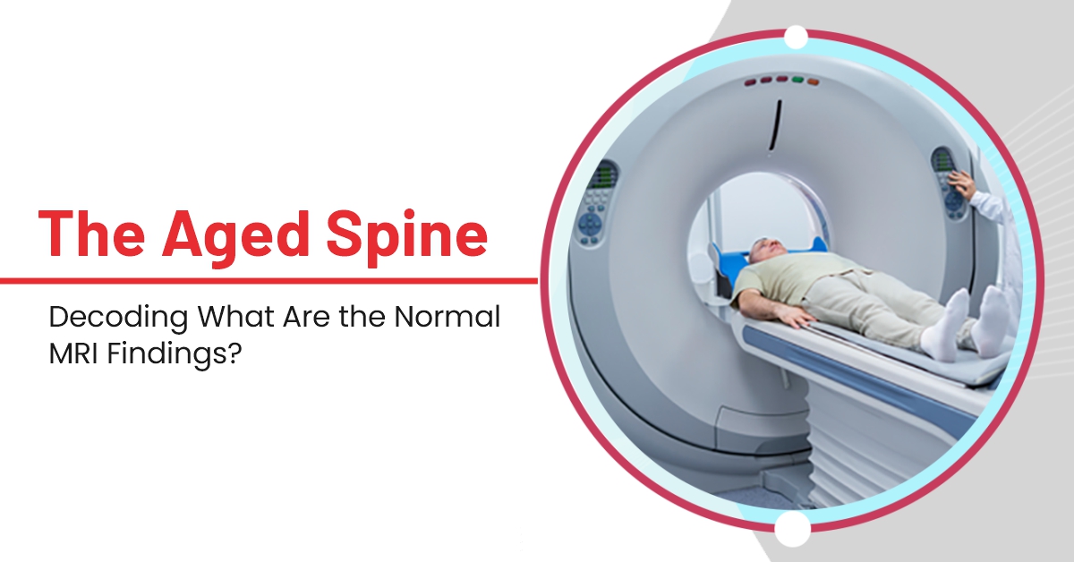 The Aged Spine -Decoding What Are the Normal MRI Findings